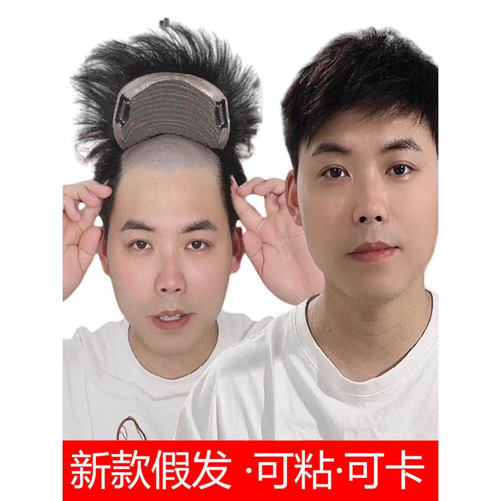 假发男士真发补发片男补发头发粘胶卡子遮盖白发假发秃顶假发片