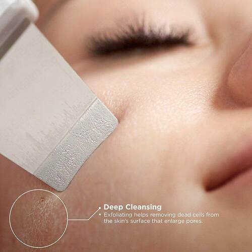 Skin Ultrasonic Scrubber Deep Face Cleaning Machine Peeling
