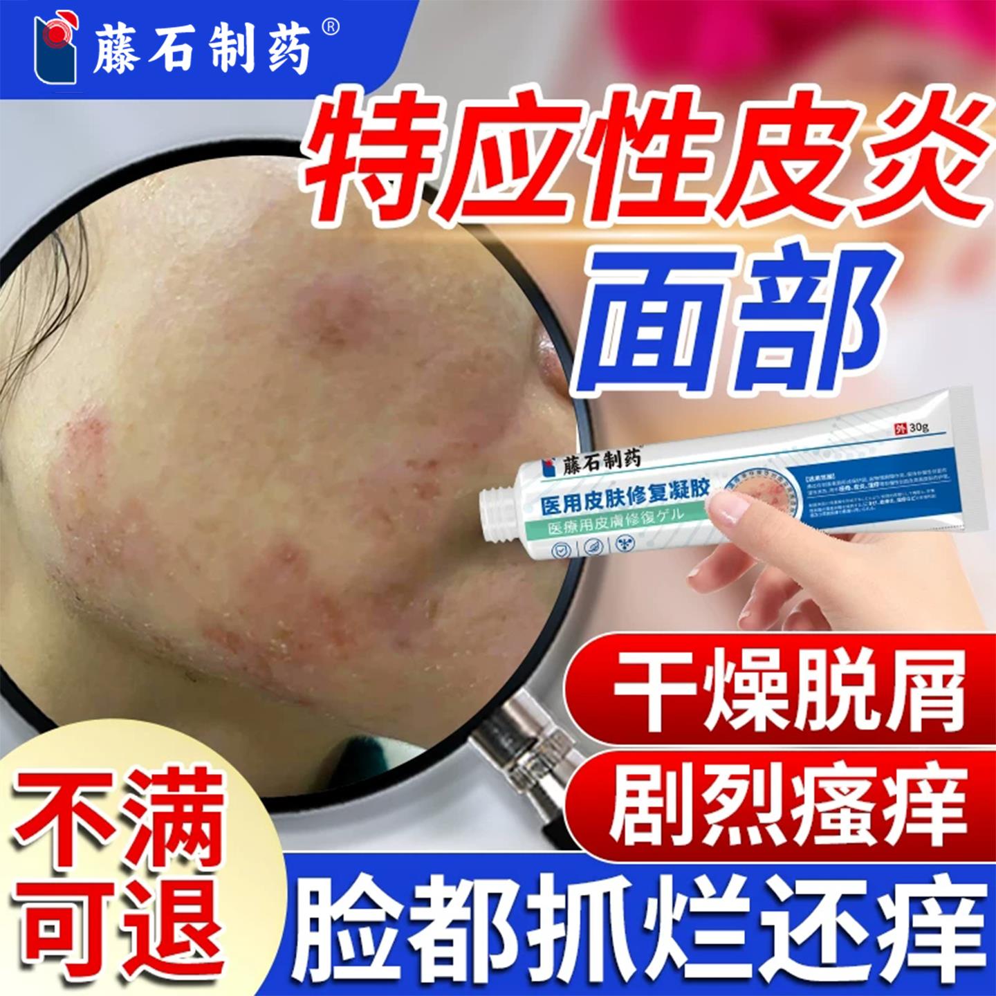 脸上干燥起皮有碎屑瘙痒癣粗糙特应性皮炎面部成人药房同售膏长QK