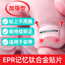 脚医生甲沟嵌甲指甲矫正器炎纠正脚沟趾甲长肉里专用胶水正甲贴片