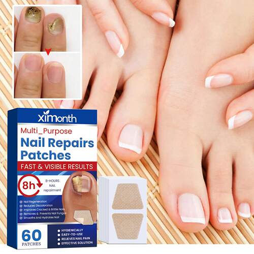 Ximonth Nail Repair Patches for Hand and Foot - Soft, Thicke