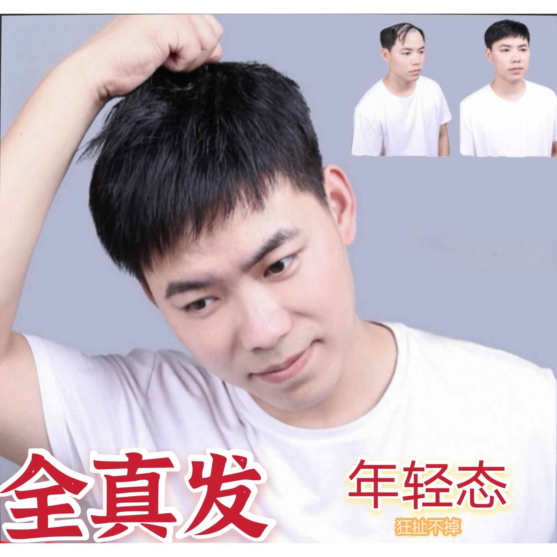 假发男头顶前额补发片寸头短发中老年翻盖真发发际线隐形光头发套