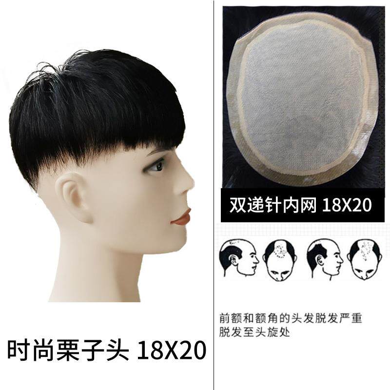 正品假短发男帅气韩版栗子头男士假发补发片发头顶无真发隐形痕补
