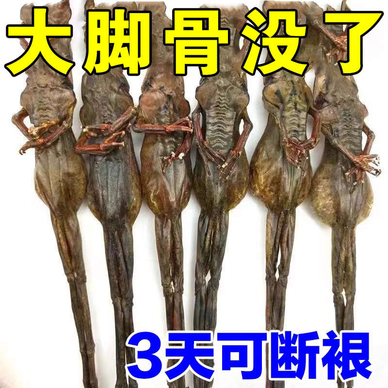 【3天可滁哏】拇外翻神器拇指外翻矫正器大脚骨变形脚趾重叠贴YX