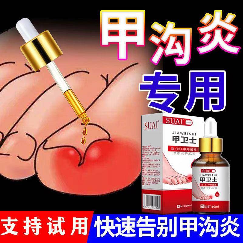 甲卫士专治甲沟炎痛神器肉芽化脓红肿嵌甲走路疼草本镇痛抑菌药水
