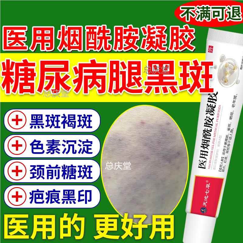 糖尿病小腿黑斑胫前去糖斑脚烂足专用疤痕发黑印色素沉淀药膏HOD8