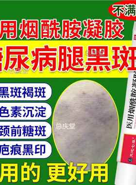 糖尿病小腿黑斑胫前去糖斑脚烂足专用疤痕发黑印色素沉淀药膏HOD8