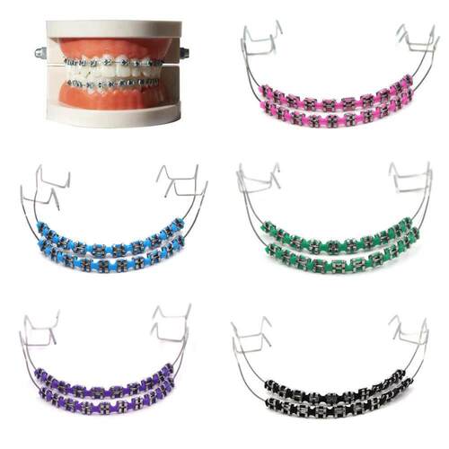 2 Pcs Trendy Braces Jewelry Set | Colorful Dental Braces Spa