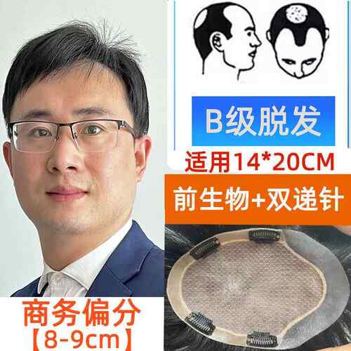 新款假发男士递针真发仿真片隐形头顶发全手织地中海秃双头男生补