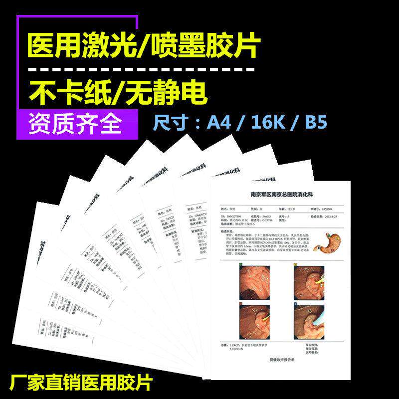包邮医院用瓷 白A4喷墨胶片防水 胃肠镜病理 B超四维彩超声打印