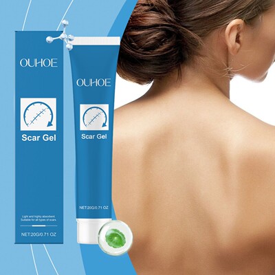 OUHOE Skin Care Gel, gently nourishes and moisturizes the sk