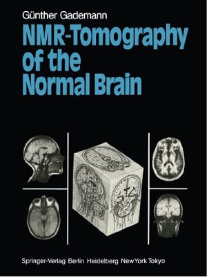【预订】NMR-Tomography of the Normal Brain