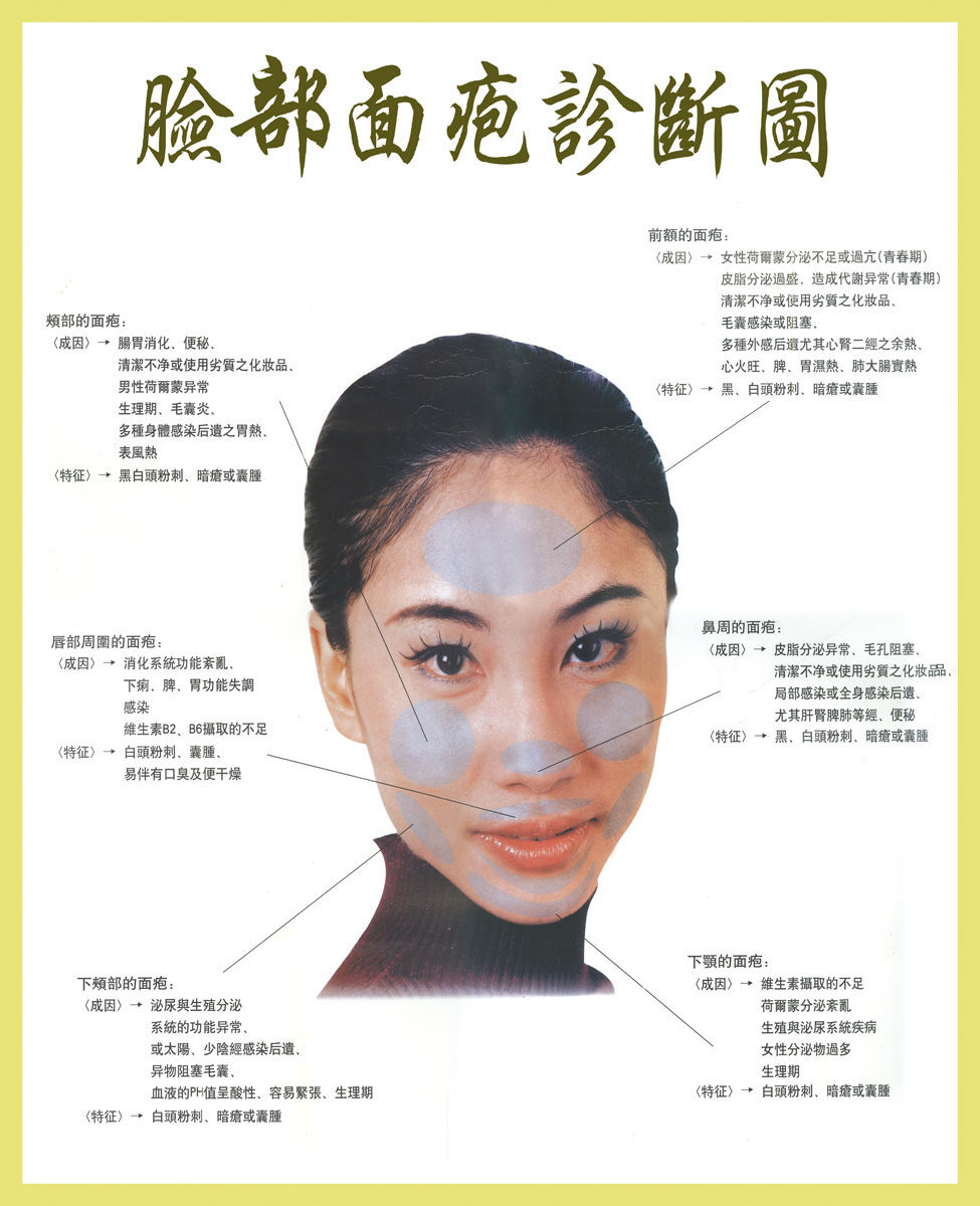 569海报印制海报展板素材540脸部面疱诊断图