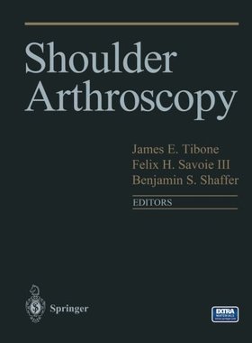 【预订】Shoulder Arthroscopy