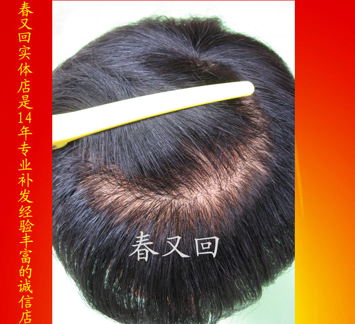 Extension cheveux - Ref 224272 Image 1