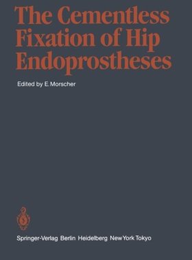 【预订】The Cementless Fixation of Hip Endop...