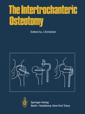 【预订】The Intertrochanteric Osteotomy