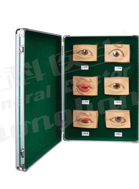 常见眼病模型（20只/套）A17110/解剖模型