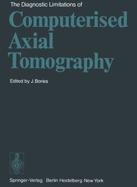 【预订】The Diagnostic Limitations of Comput...