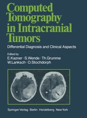 【预订】Computed Tomography in Intracranial ...