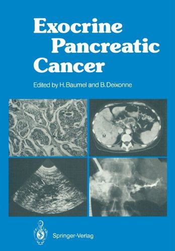 【预订】exocrine pancreatic cancer