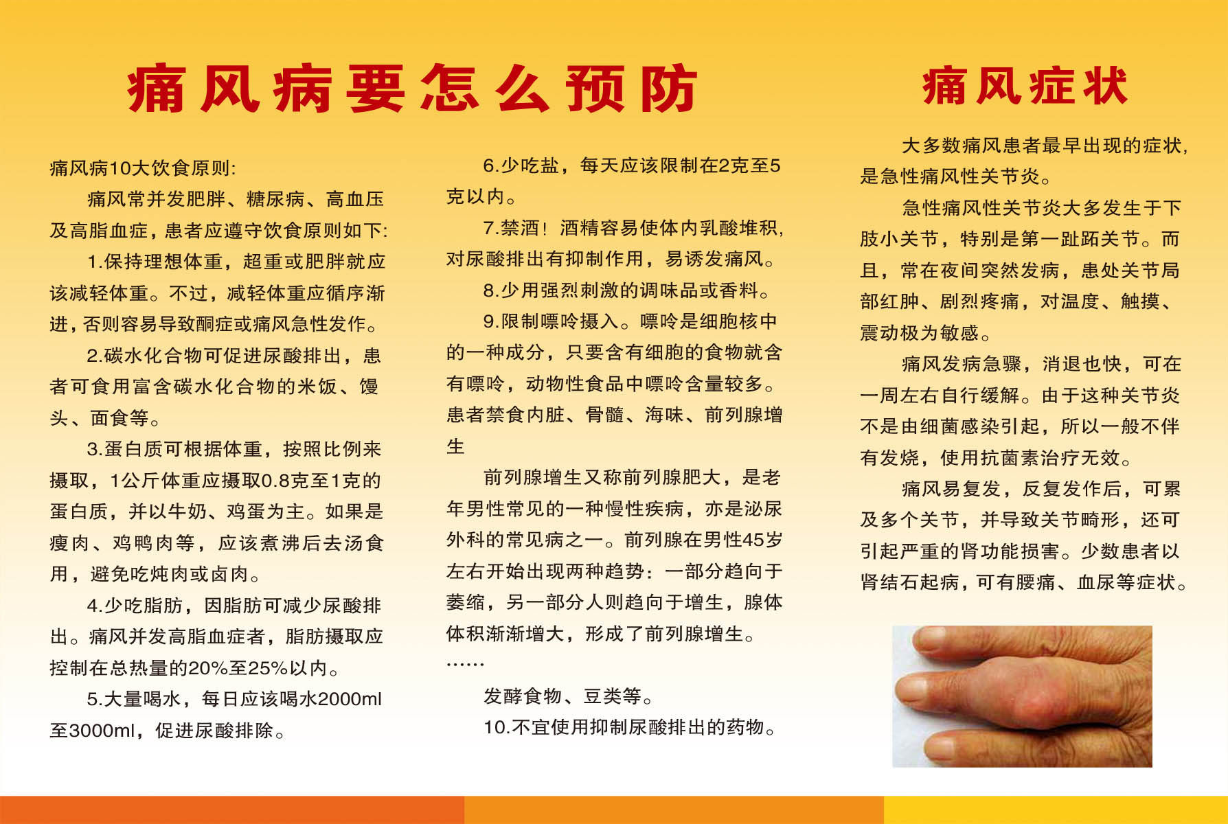 41海报常见疾病海报展板挂图267痛风病反面海报印制