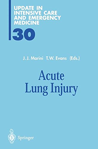【预订】Acute Lung Injury