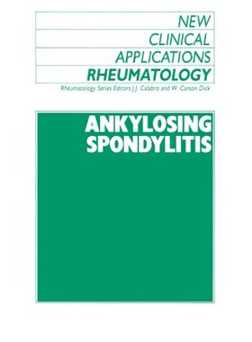 【预订】Ankylosing Spondylitis