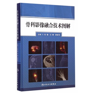 ZJ包邮正版 骨科影像融合技术图解 张敏,汪静,郭智萍 新华书店书籍图书 医学 外科学 骨科