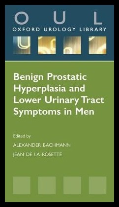 美国库房发货，通常付款后5-8周到货！