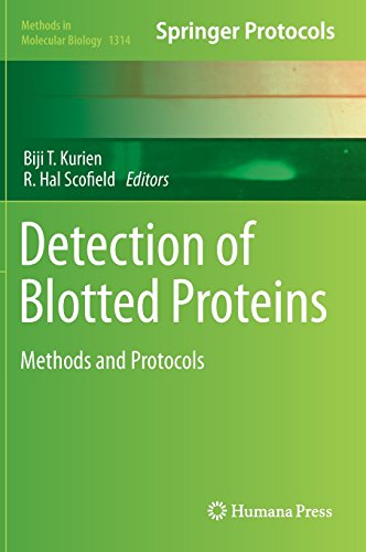 【预订】Detection of Blotted Proteins
