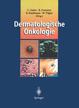 【预订】Dermatologische Onkologie