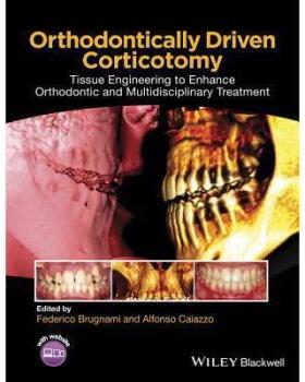 【预订】Orthodontically Driven Corticotomy