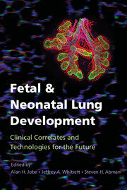 【预订】Fetal and Neonatal Lung Development