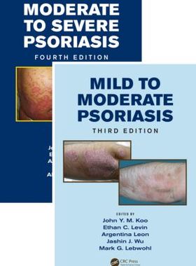 【预售】Mild to Moderate and Moderate to Severe Psoriasis