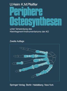【预订】Periphere Osteosynthesen: Unter Verw...