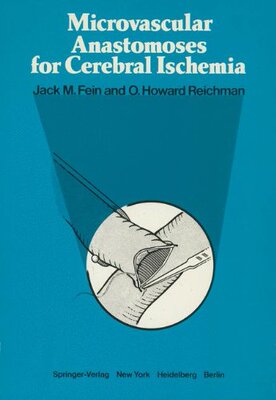 【预售】Microvascular Anastomoses for Cerebral Ischemia