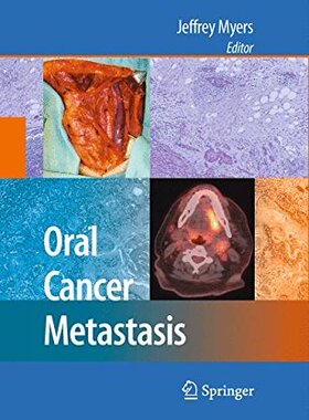 【预订】Oral Cancer Metastasis