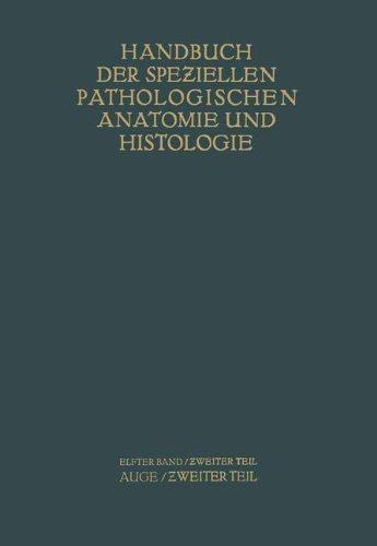 【预订】auge: zweiter teil