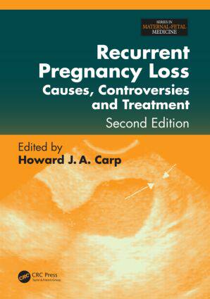 【预售】Recurrent Pregnancy Loss: Causes, Controversie...