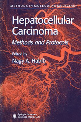 【预订】Hepatocellular Carcinoma: Methods an...
