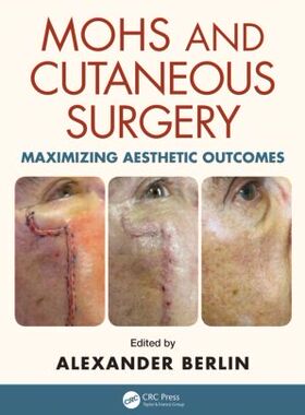 【预售】Mohs and Cutaneous Surgery: Maximizing Aesthet...