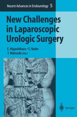 美国库房发货,通常付款后5-8周到货！