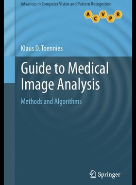 【预售】Guide to Medical Image Analysis: Methods and Algo