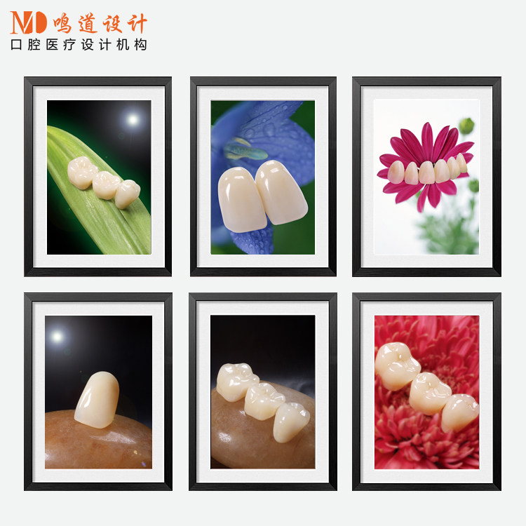 口腔诊所装饰画 牙科宣传画挂图 整形医院软装墙壁画 牙齿有框画