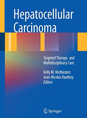 【预订】Hepatocellular Carcinoma: