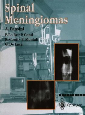 【预订】Spinal Meningiomas