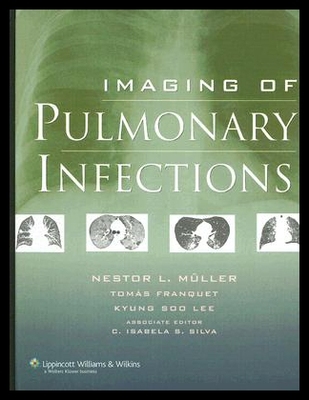 【预售】Imaging of Pulmonary Infections