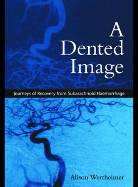 【预售】A Dented Image: Journeys of Recovery from Subar