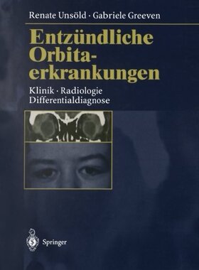 【预订】Entzundliche Orbitaerkrankungen: Kli...